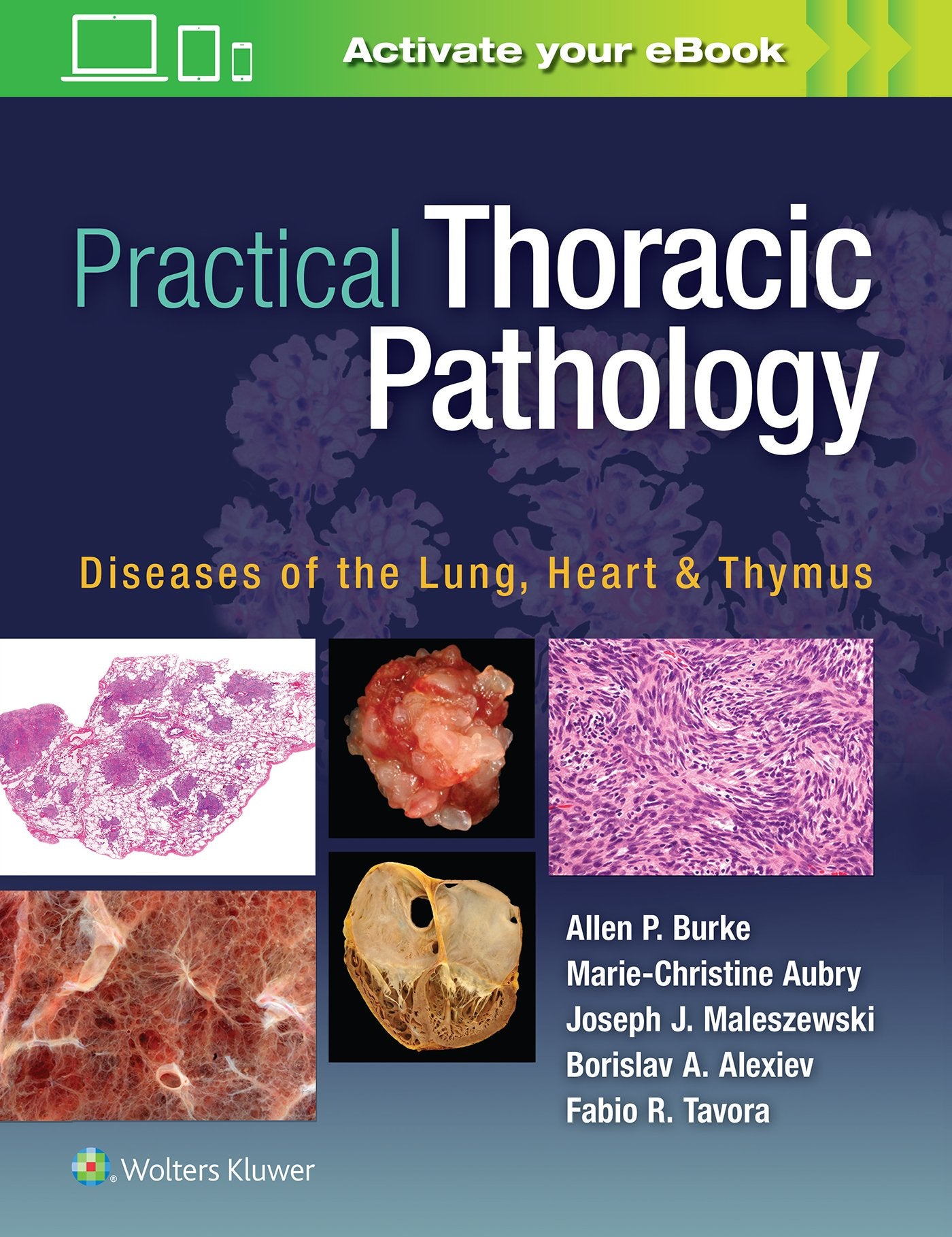 Practical Thoracic Pathology: Diseases of the Lung
