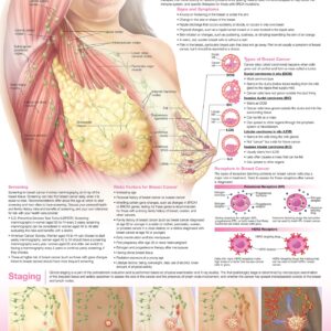 Understanding Breast Cancer Anatomical Chart-ISBN: 9781975192297