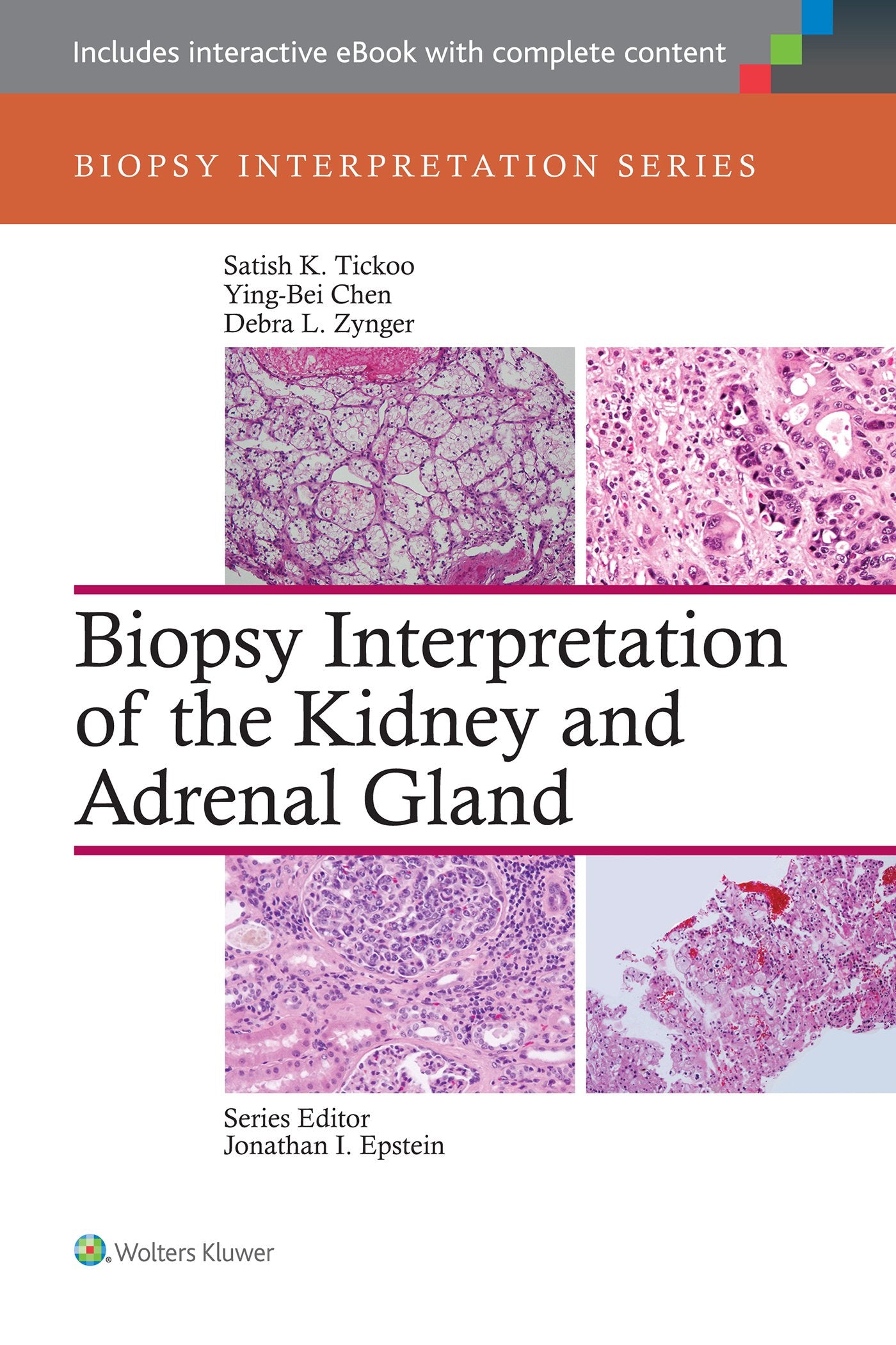 Biopsy Interpretation of the Kidney & Adrenal Gland-ISBN: 9781451176476