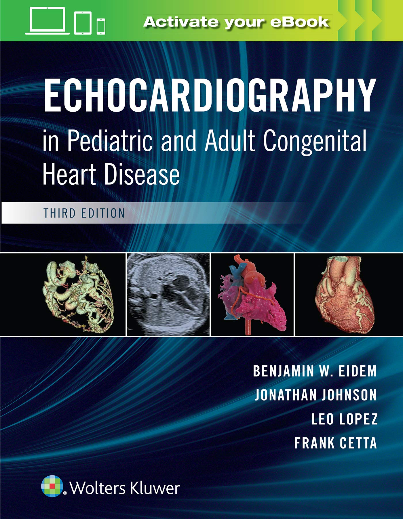 Echocardiography in Pediatric and Adult Congenital Heart Disease-ISBN: 9781496394019