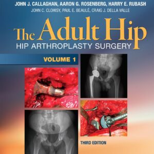 The Adult Hip (Two Volume Set): Hip Arthroplasty Surgery-ISBN: 9781451183696