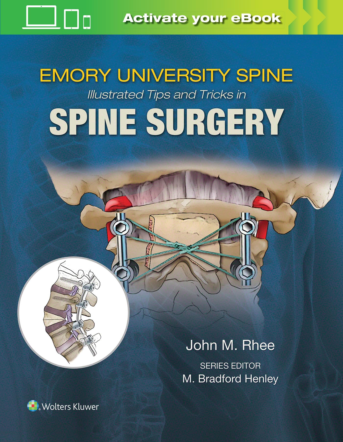Emory's Illustrated Tips and Tricks in Spine Surgery-ISBN: 9781496375193