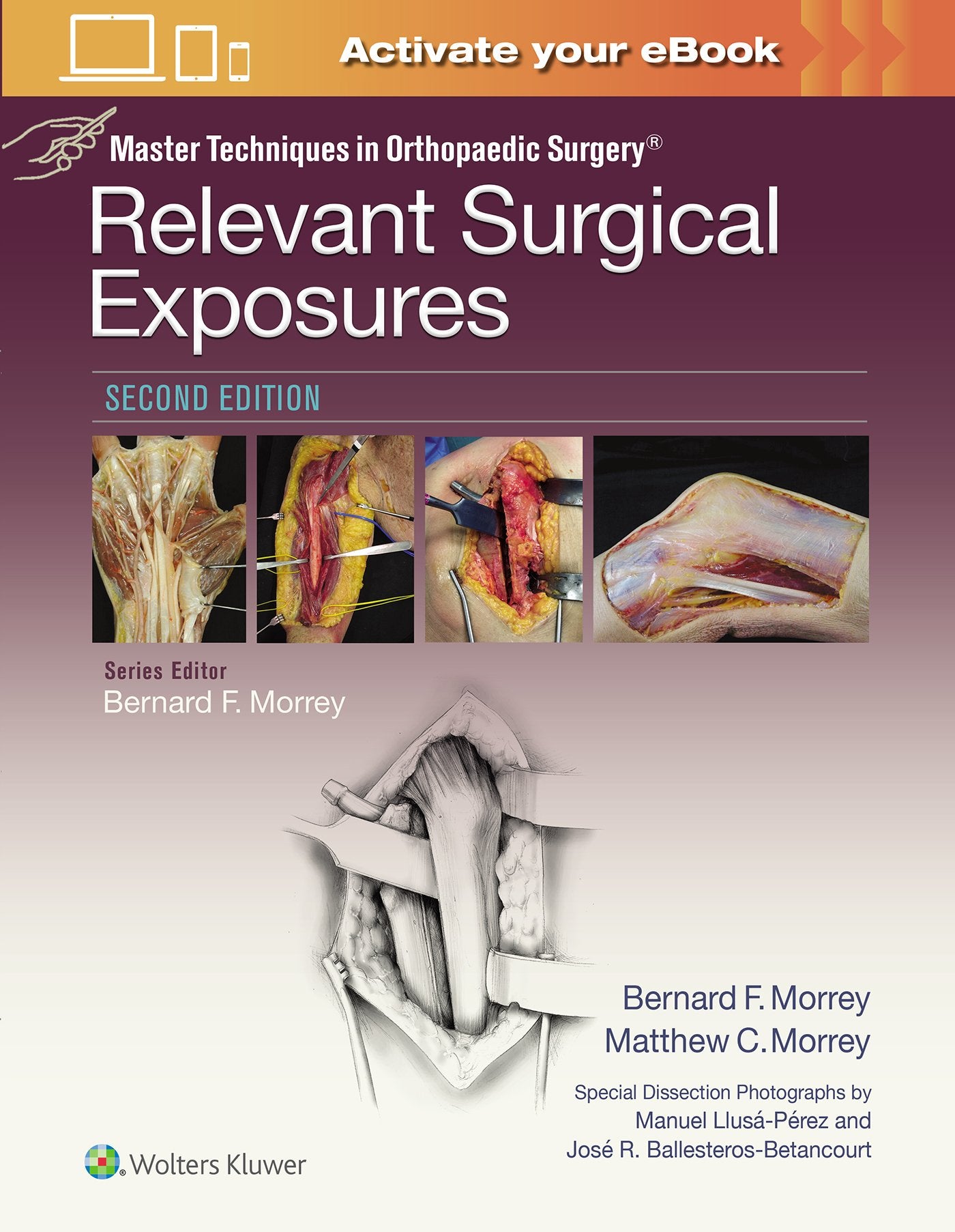 Master Techniques in Orthopaedic Surgery: Relevant Surgical Exposures-ISBN: 9781451194067