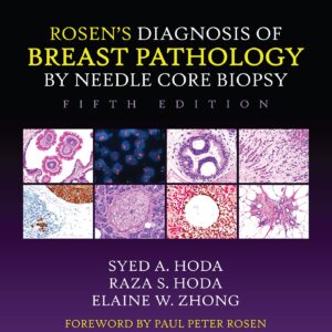 Rosen's Diagnosis of Breast Pathology by Needle Core Biopsy-ISBN: 9781975198367
