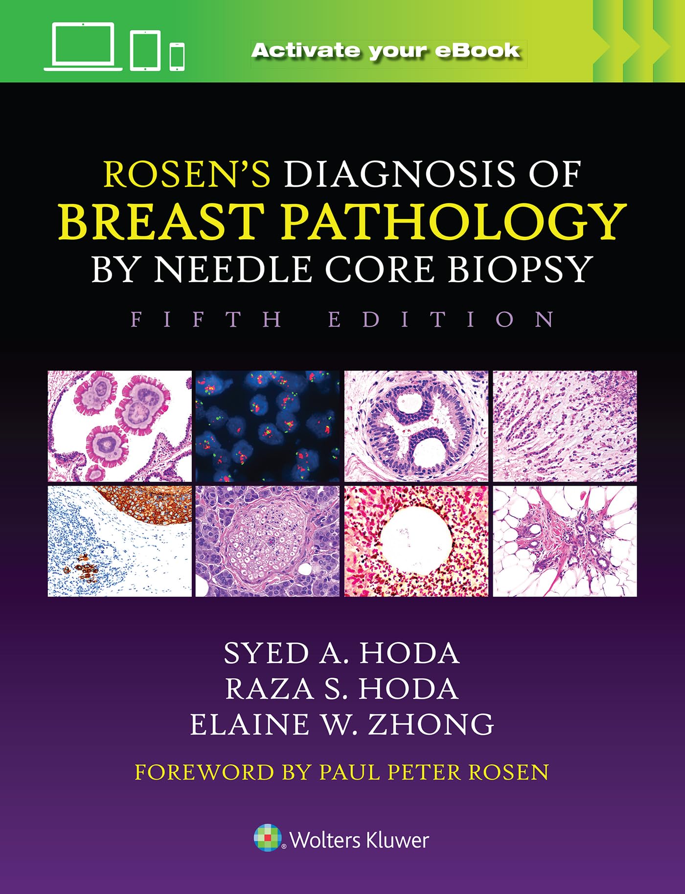 Rosen's Diagnosis of Breast Pathology by Needle Core Biopsy-ISBN: 9781975198367