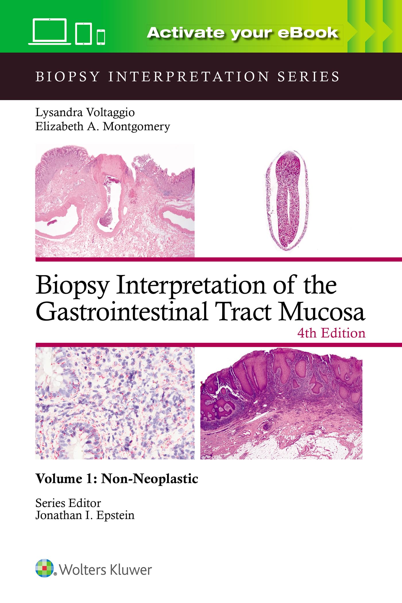 Biopsy Interpretation of the Gastrointestinal Tract Mucosa Volume 1: Non-Neoplastic: Print + eBook with Multimedia (Volume 1)-ISBN: 9781975213664