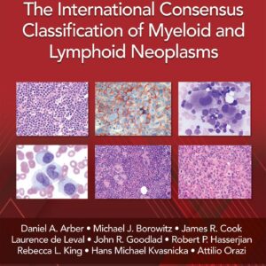 The International Consensus Classification of Myeloid and Lymphoid Neoplasms-ISBN: 9781975222598