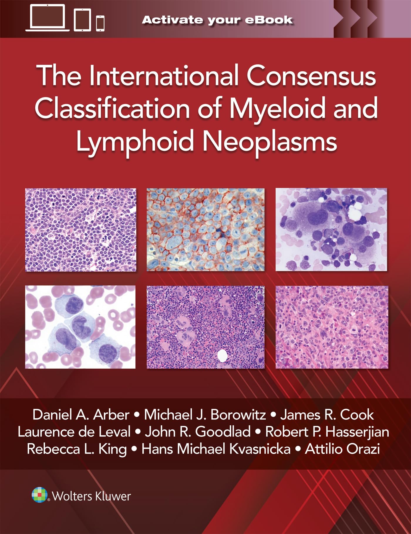 The International Consensus Classification of Myeloid and Lymphoid Neoplasms-ISBN: 9781975222598