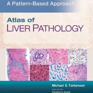 Atlas of Liver Pathology: A Pattern-Based Approach-ISBN: 9781496396976