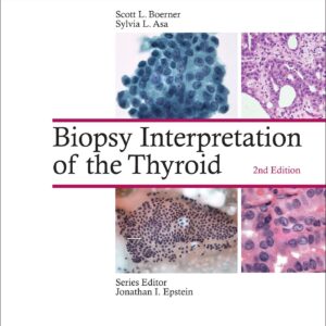Biopsy Interpretation of the Thyroid-ISBN: 9781496355850