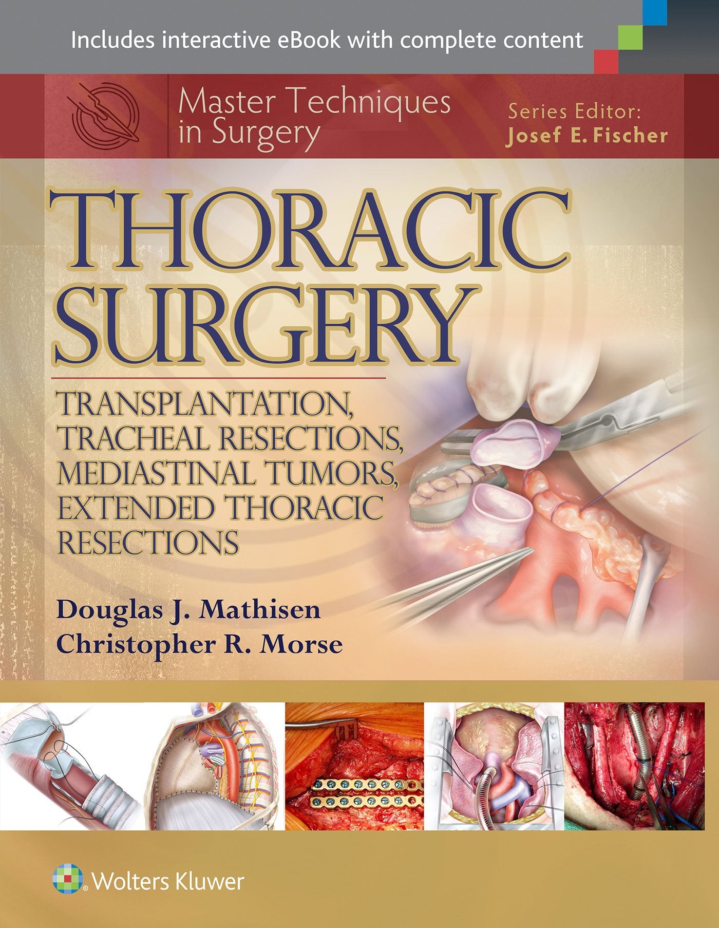 Master Techniques in Surgery: Thoracic Surgery: Transplantation