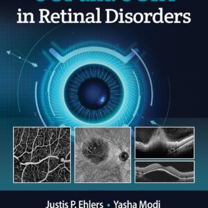 OCT and OCTA in Retinal Disorders-ISBN: 9781975144227