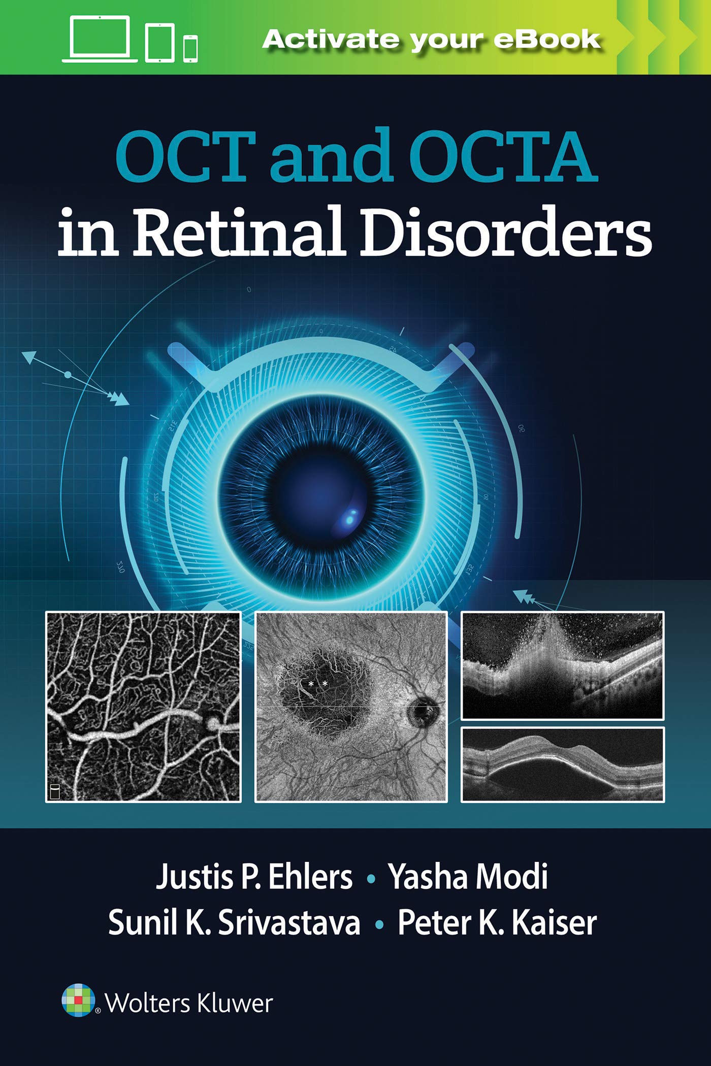 OCT and OCTA in Retinal Disorders-ISBN: 9781975144227