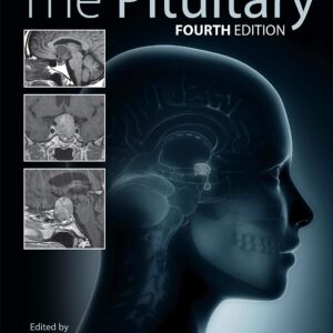 The Pituitary