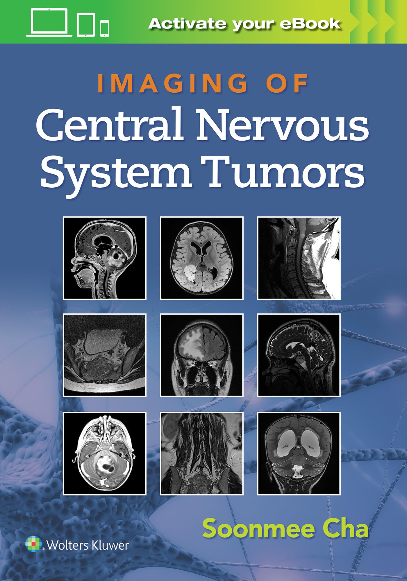 Imaging of Central Nervous System Tumors-ISBN: 9781975103743