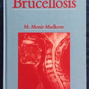 Brucellosis