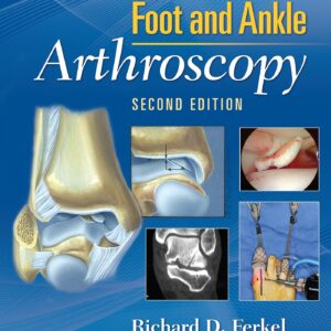 Foot & Ankle Arthroscopy-ISBN: 9780781783415