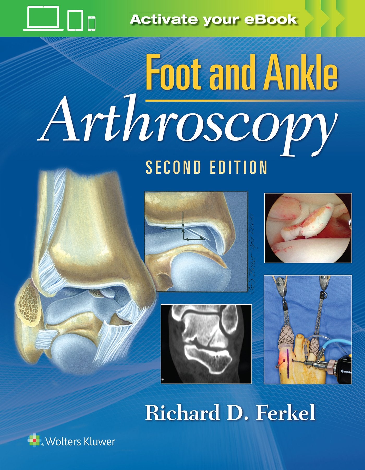 Foot & Ankle Arthroscopy-ISBN: 9780781783415