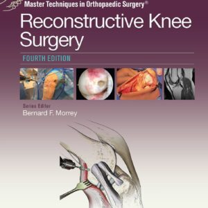 Master Techniques in Orthopaedic Surgery: Reconstructive Knee Surgery-ISBN: 9781496318275
