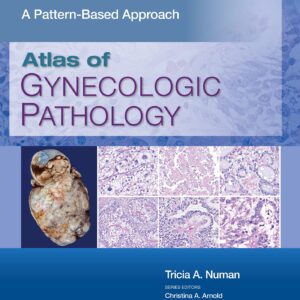 Atlas of Gynecologic Pathology: A Pattern-Based Approach: Print + eBook with Multimedia-ISBN: 9781975124762