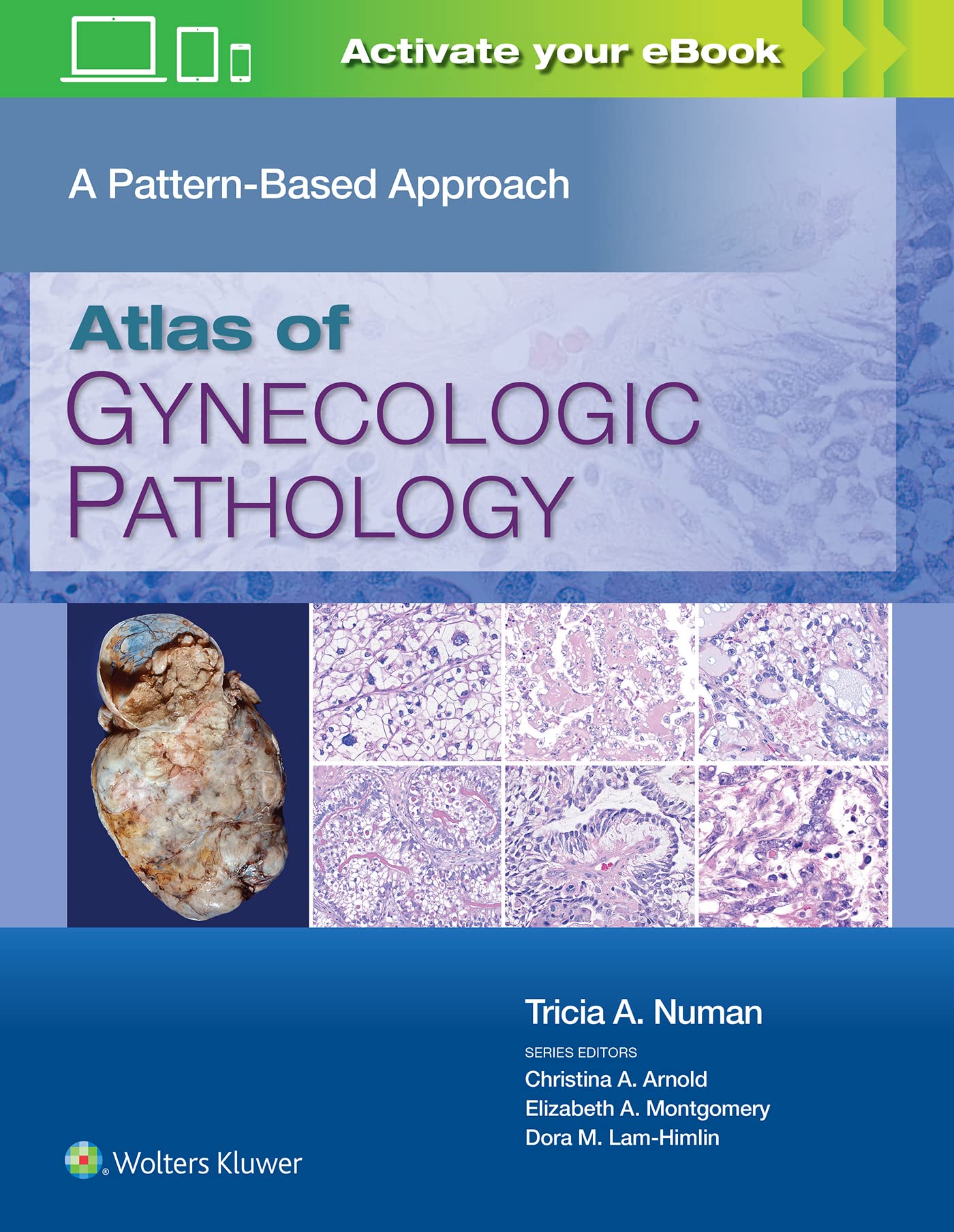 Atlas of Gynecologic Pathology: A Pattern-Based Approach: Print + eBook with Multimedia-ISBN: 9781975124762