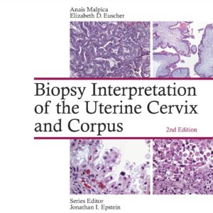 Biopsy Interpretation of the Uterine Cervix and Corpus (Biopsy Interpretation Series)-ISBN: 9781451192964