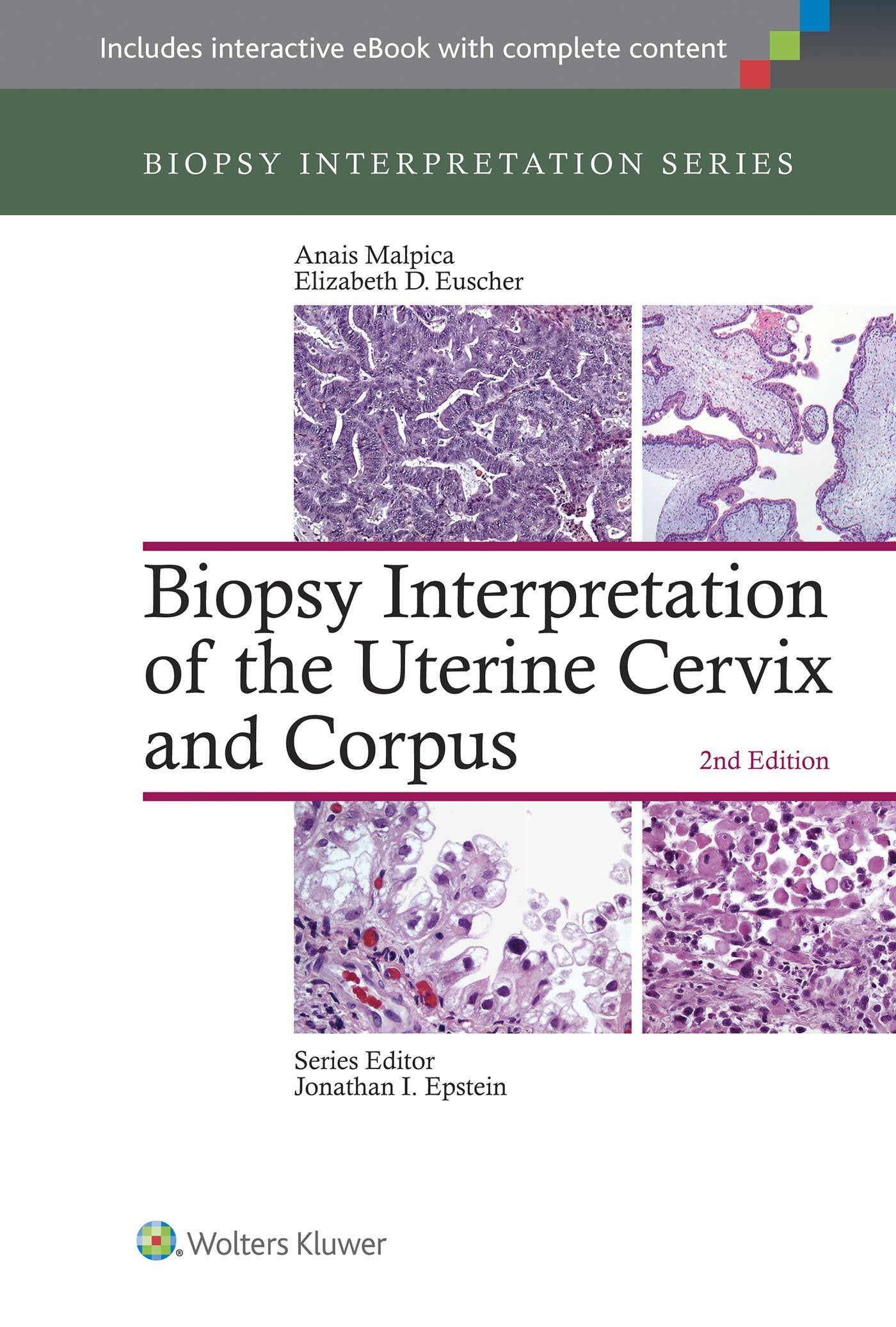Biopsy Interpretation of the Uterine Cervix and Corpus (Biopsy Interpretation Series)-ISBN: 9781451192964