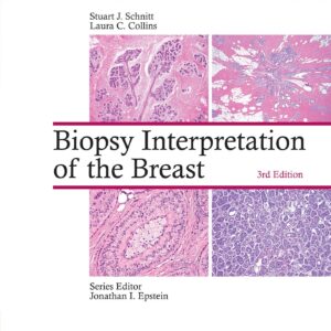 Biopsy Interpretation of the Breast-ISBN: 9781496365750