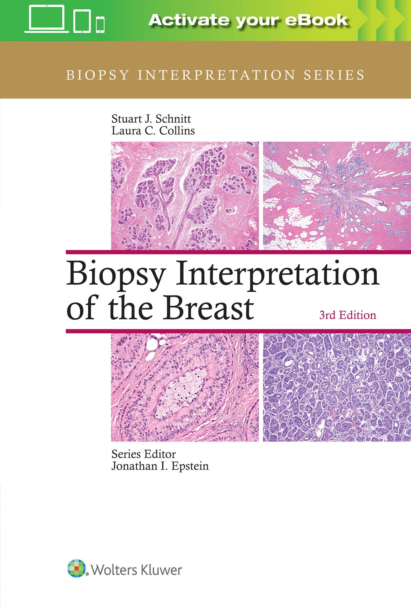 Biopsy Interpretation of the Breast-ISBN: 9781496365750