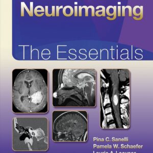 Neuroimaging: The Essentials (Essentials Series)-ISBN: 9781451191356