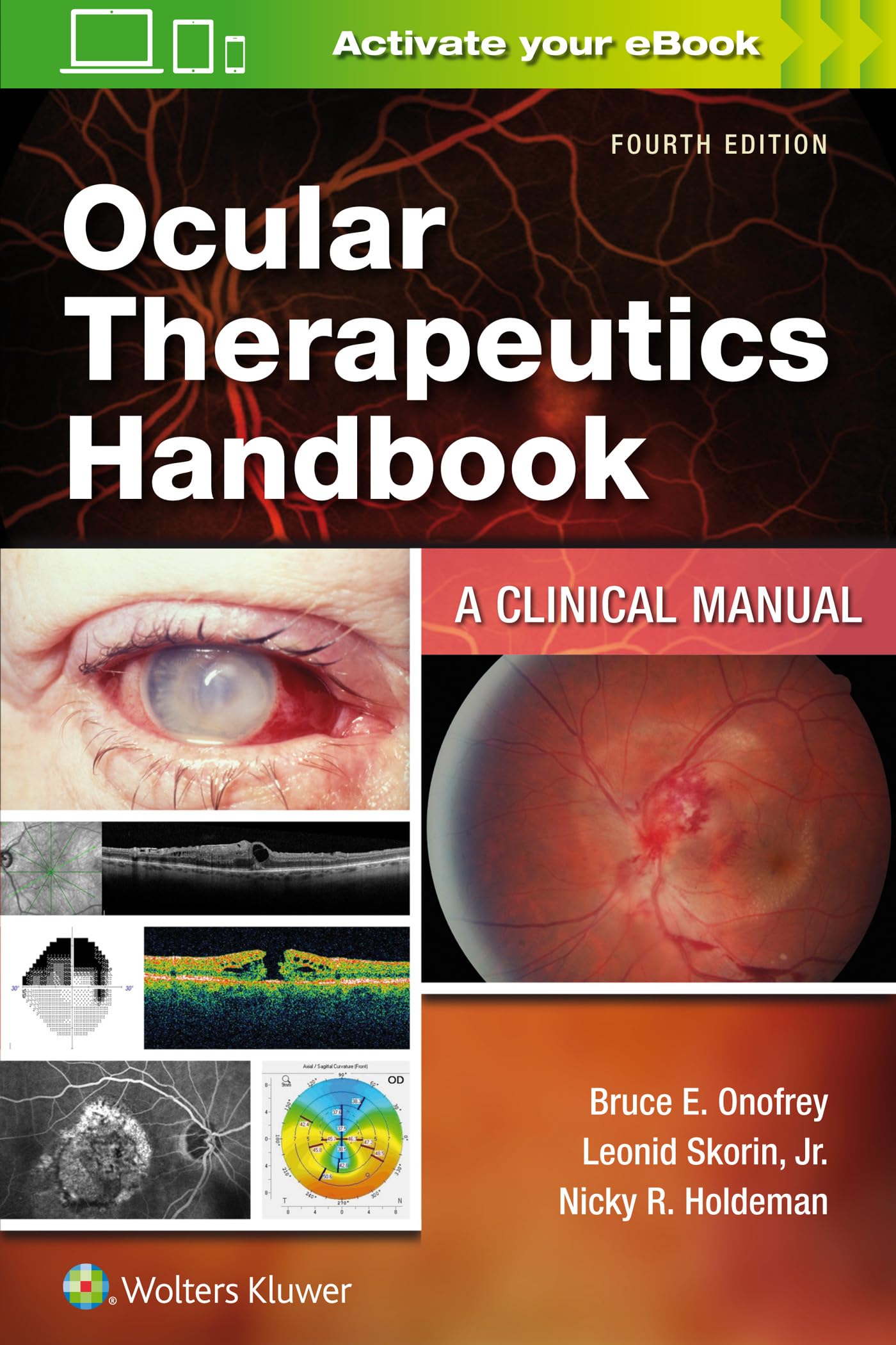 Ocular Therapeutics Handbook: A Clinical Manual-ISBN: 9781975109042