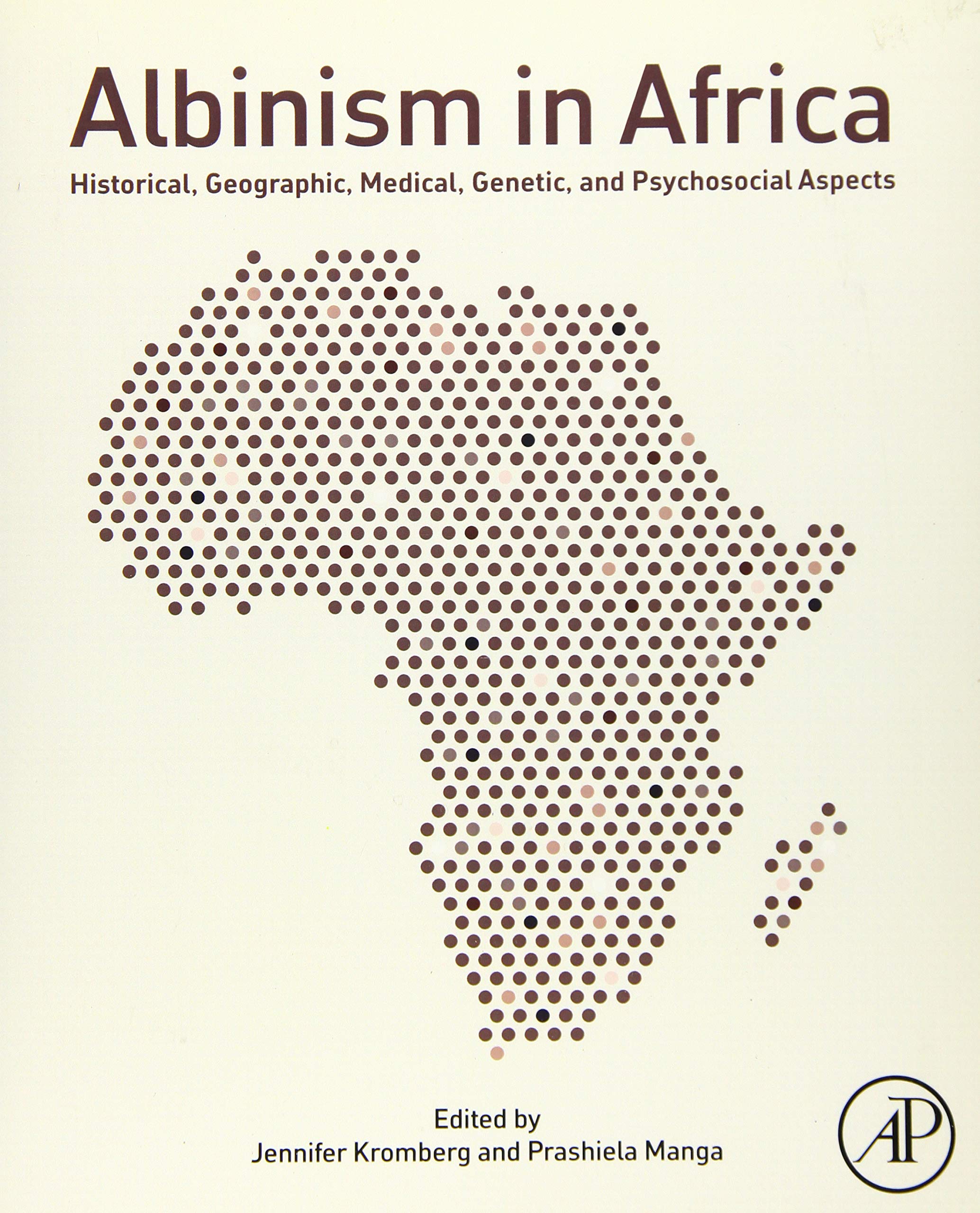 Albinism in Africa: Historical