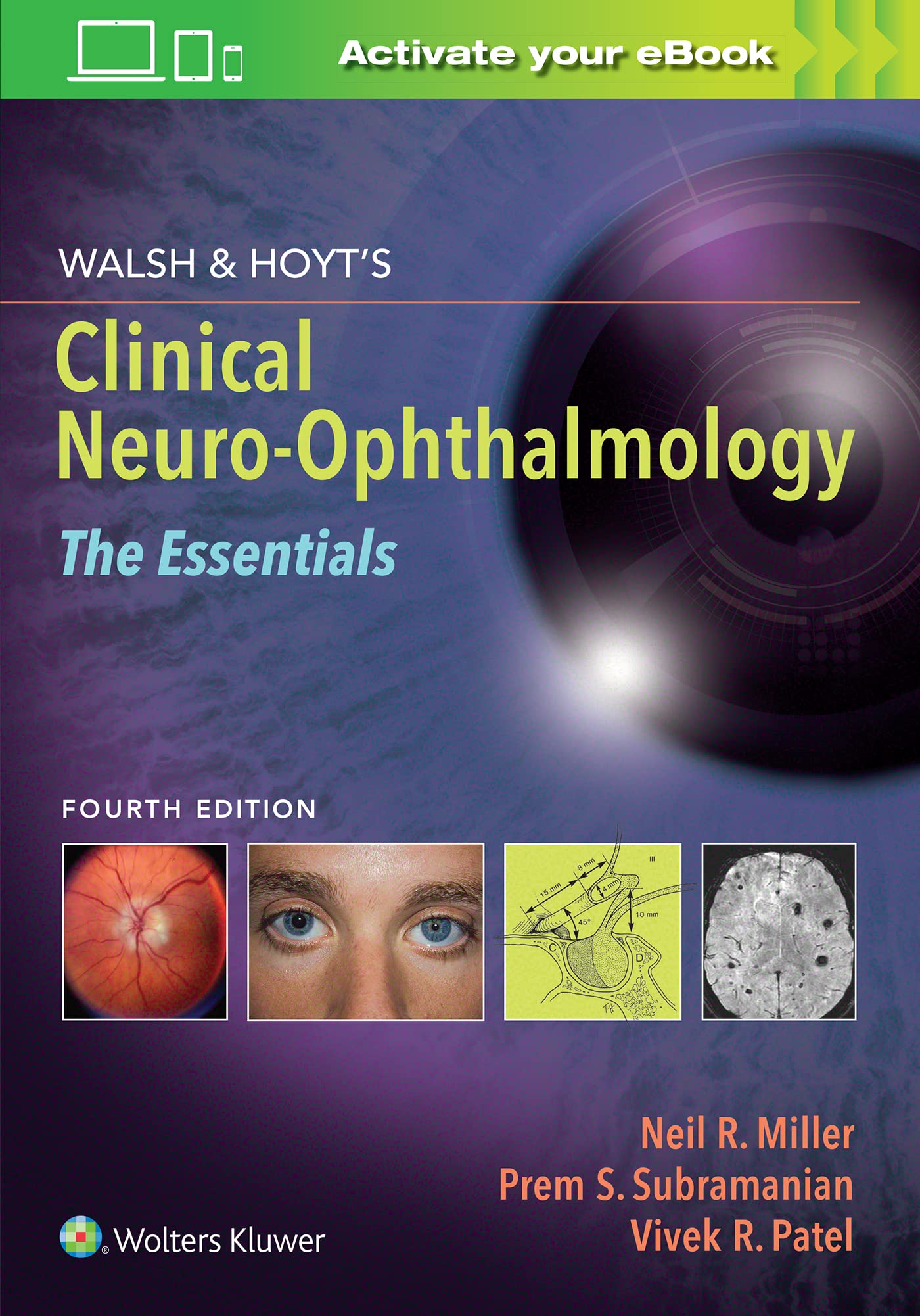 Walsh & Hoyt's Clinical Neuro-Ophthalmology: The Essentials-ISBN: 9781975118914
