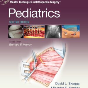 Master Techniques in Orthopaedic Surgery: Pediatrics-ISBN: 1451194447
