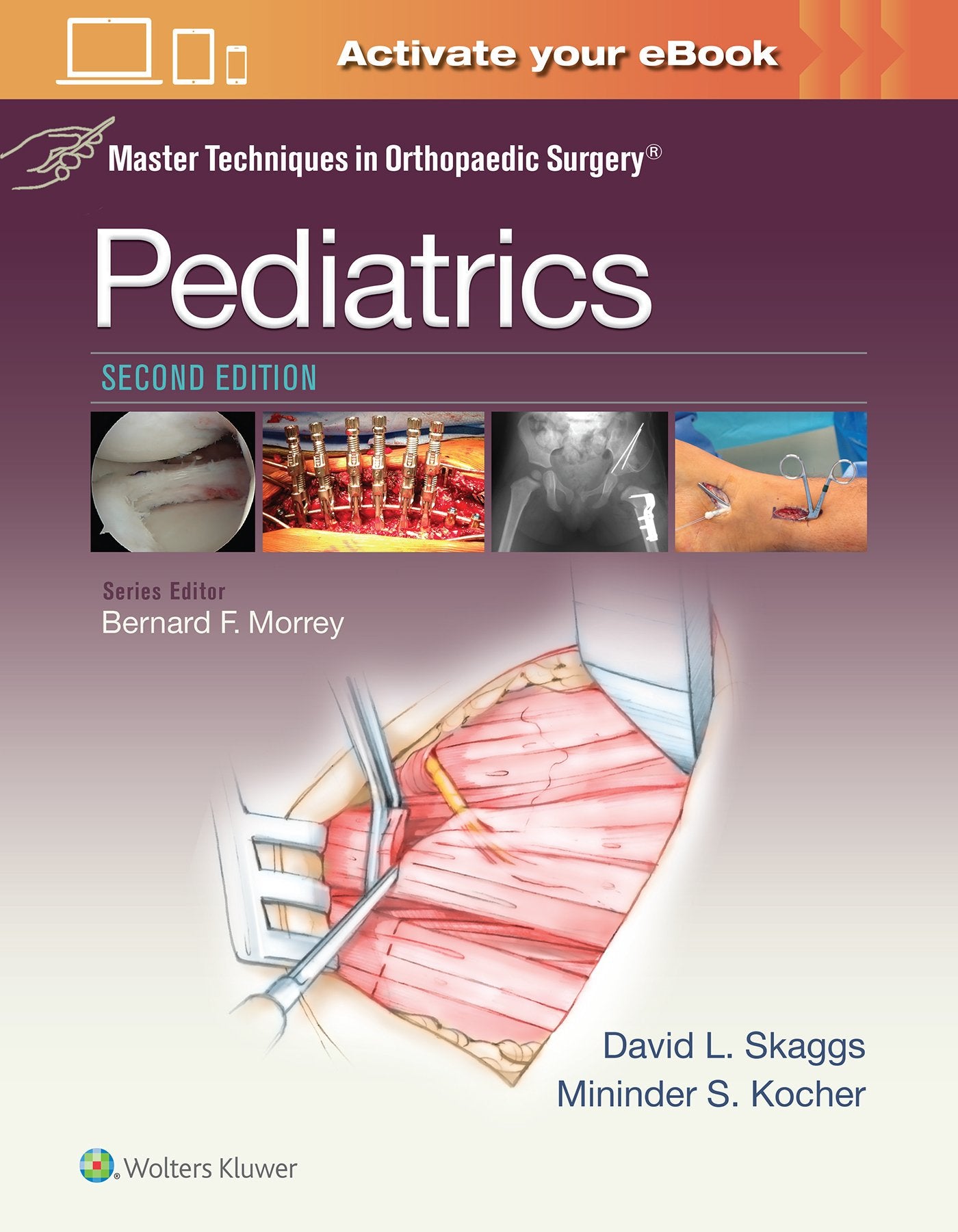 Master Techniques in Orthopaedic Surgery: Pediatrics-ISBN: 1451194447