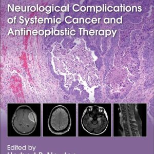 Neurological Complications of Systemic Cancer and Antineoplastic Therapy
