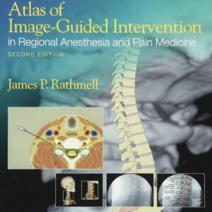 Atlas of Image-Guided Intervention in Regional Anesthesia and Pain Medicine-ISBN: 9781608317042