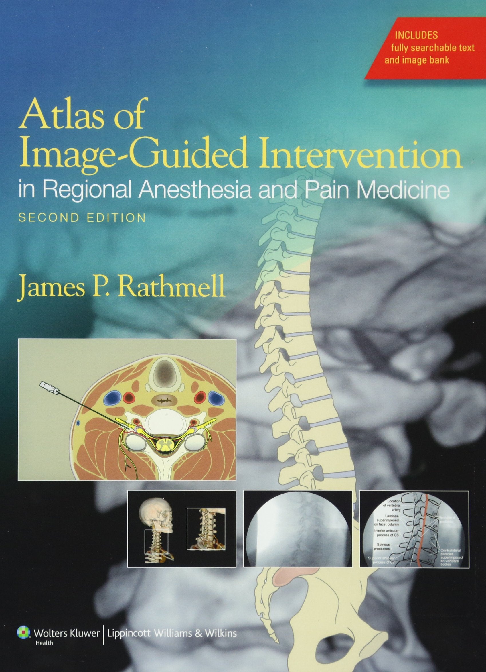Atlas of Image-Guided Intervention in Regional Anesthesia and Pain Medicine-ISBN: 9781608317042