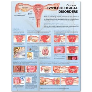 Common Gynecological Disorders Anatomical Chart-ISBN: 9780781773508