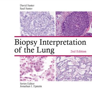 Biopsy Interpretation of the Lung (Biopsy Interpretation Series)-ISBN: 9781975136581