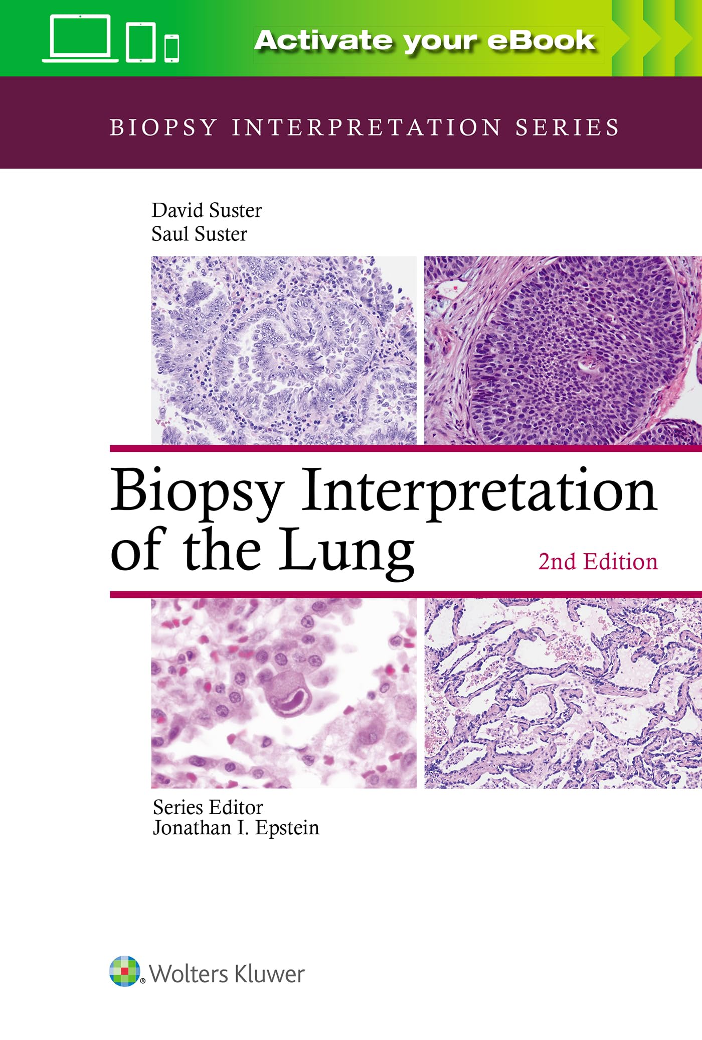 Biopsy Interpretation of the Lung (Biopsy Interpretation Series)-ISBN: 9781975136581