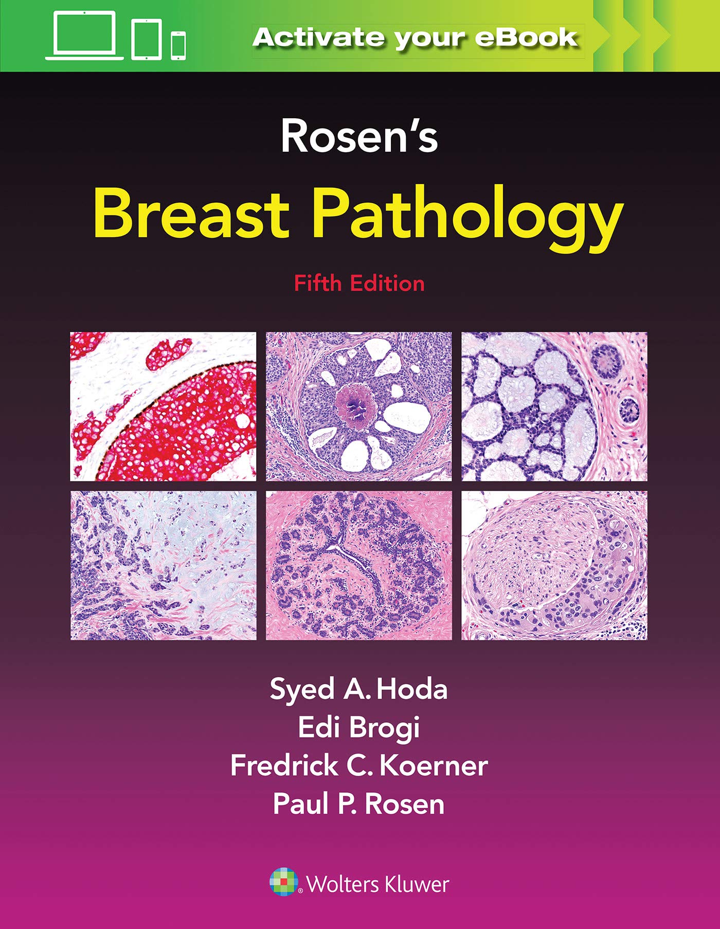 Rosen's Breast Pathology-ISBN: 9781496398918