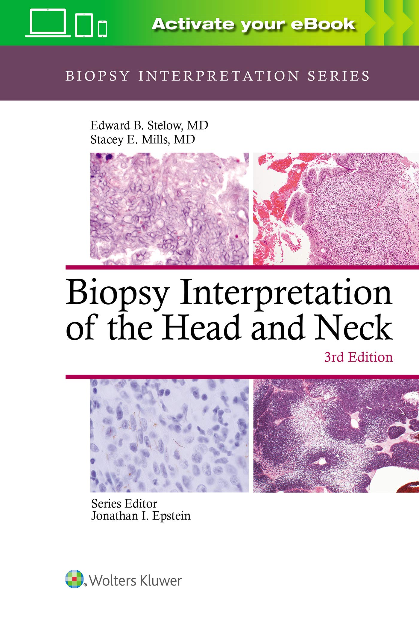 Biopsy Interpretation of the Head and Neck-ISBN: 9781975139360