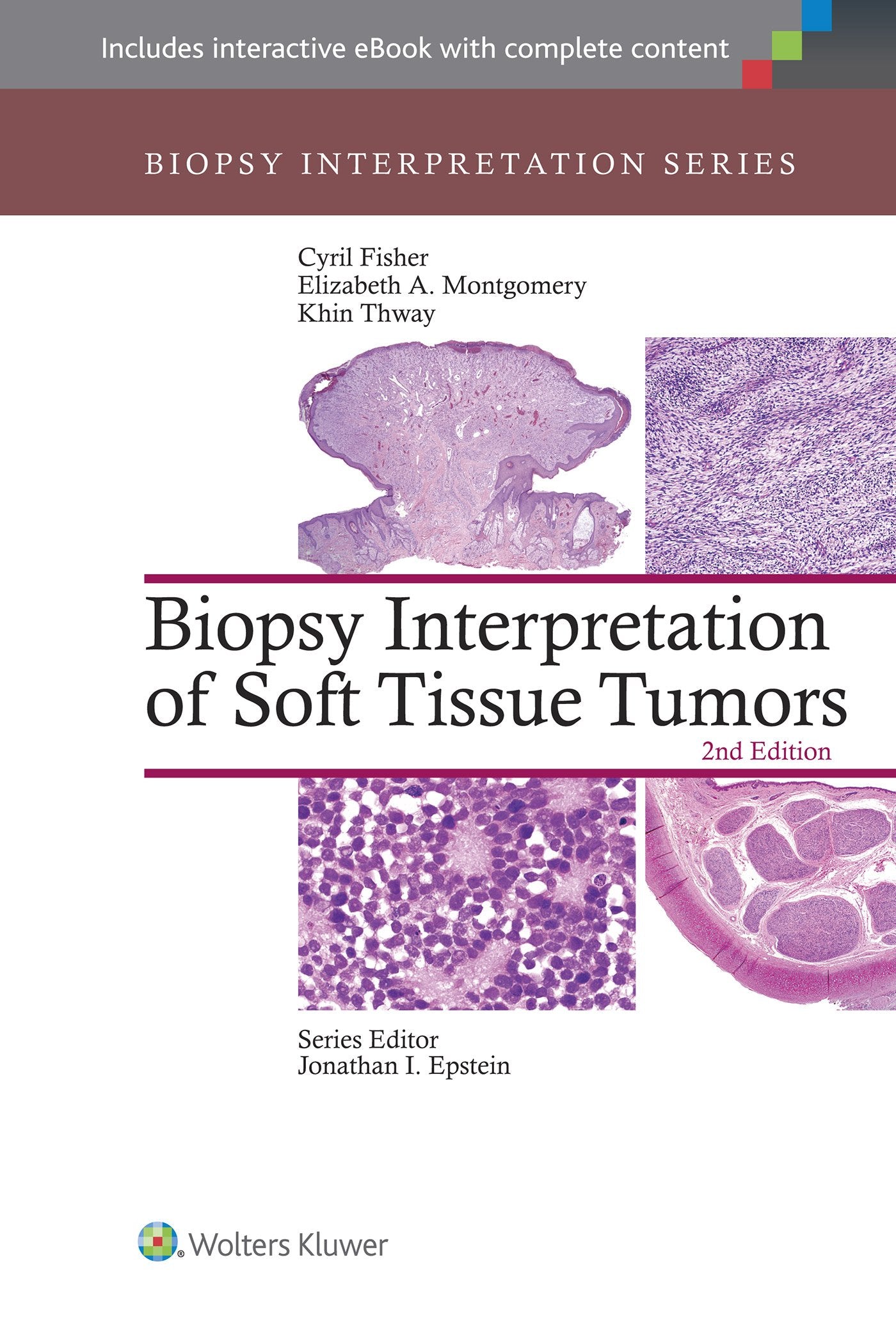 Biopsy Interpretation of Soft Tissue Tumors (Biopsy Interpretation Series)-ISBN: 9781451192995