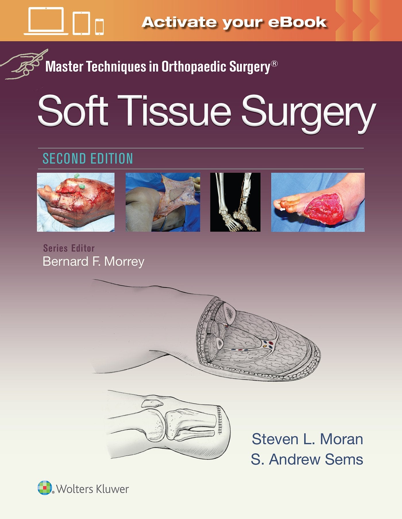 Master Techniques in Orthopaedic Surgery: Soft Tissue Surgery-ISBN: 9781496329004