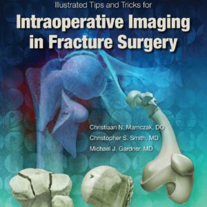 Illustrated Tips and Tricks for Intraoperative Imaging in Fracture Surgery-ISBN: 9781496328960