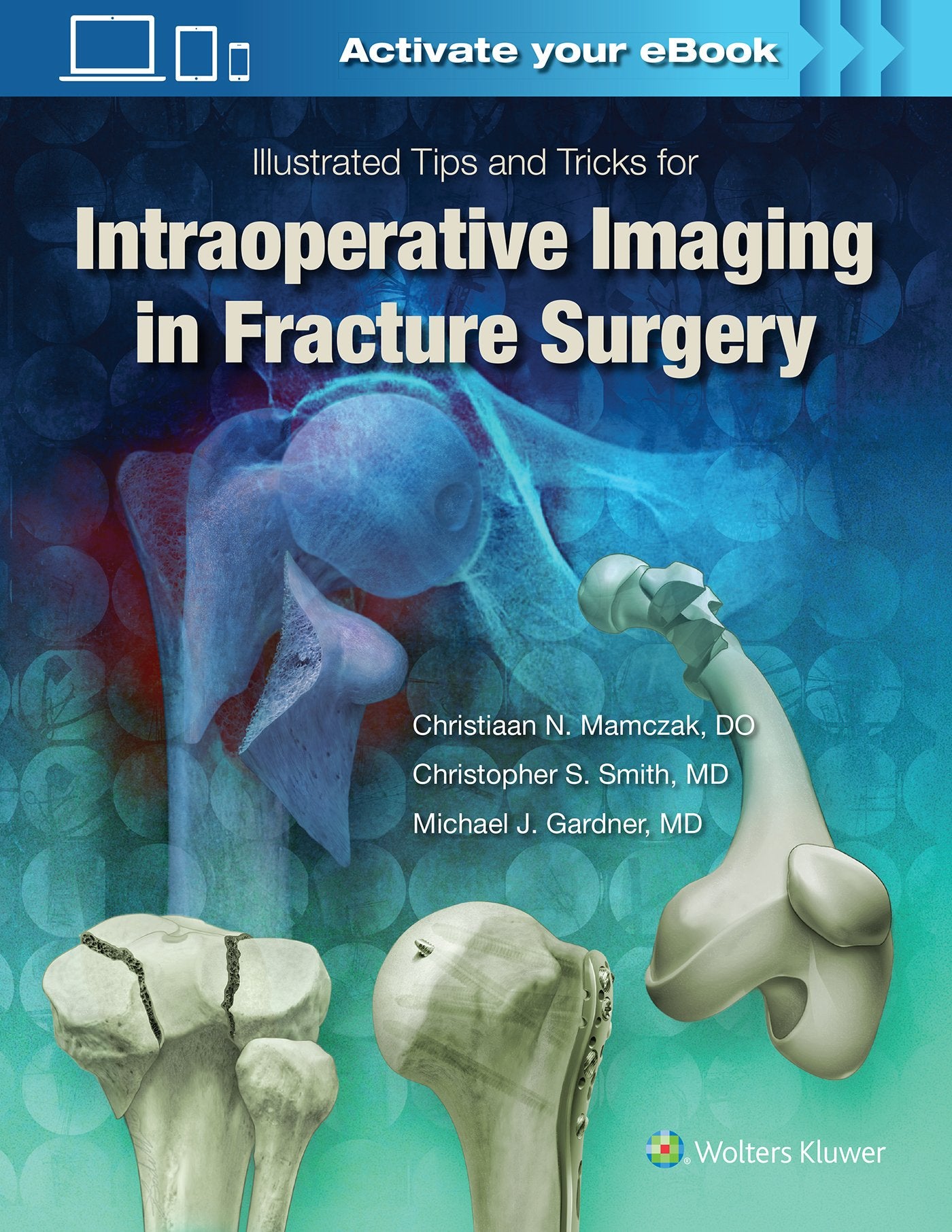 Illustrated Tips and Tricks for Intraoperative Imaging in Fracture Surgery-ISBN: 9781496328960