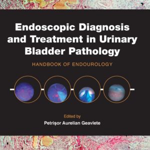 Endoscopic Diagnosis and Treatment in Urinary Bladder Pathology: Handbook of Endourology