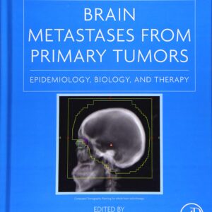 Brain Metastases from Primary Tumors