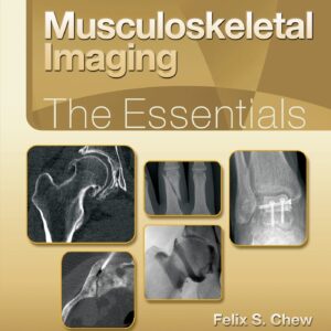 Musculoskeletal Imaging: The Essentials (Essentials Series)-ISBN: 9781496383839
